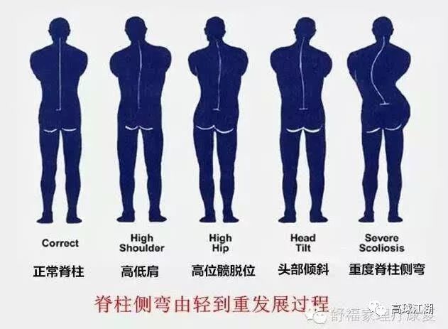 这4个最伤脊柱的姿势你每天都在做！