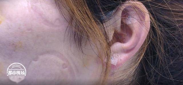 女子午休时开风扇 睡醒后面瘫