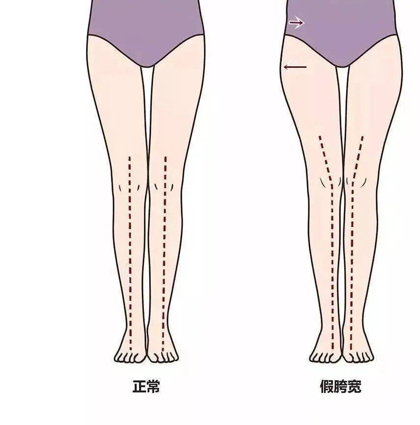 为何说歼-20垂直起降型“一眼假”