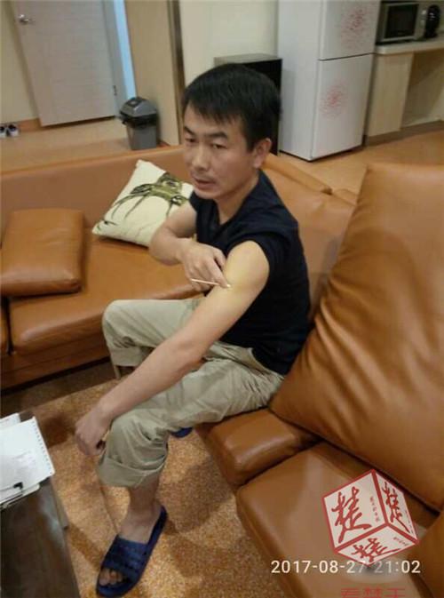 捐髓救人13天减10斤