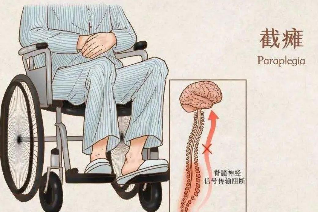 "结婚生子遭抛弃截瘫网红发声"：她的勇敢揭露引发全网热议！