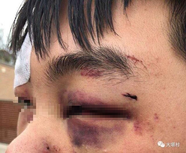 震惊！中国夫妇在澳遭殴打事件细节曝光，背后真相令人愤怒！