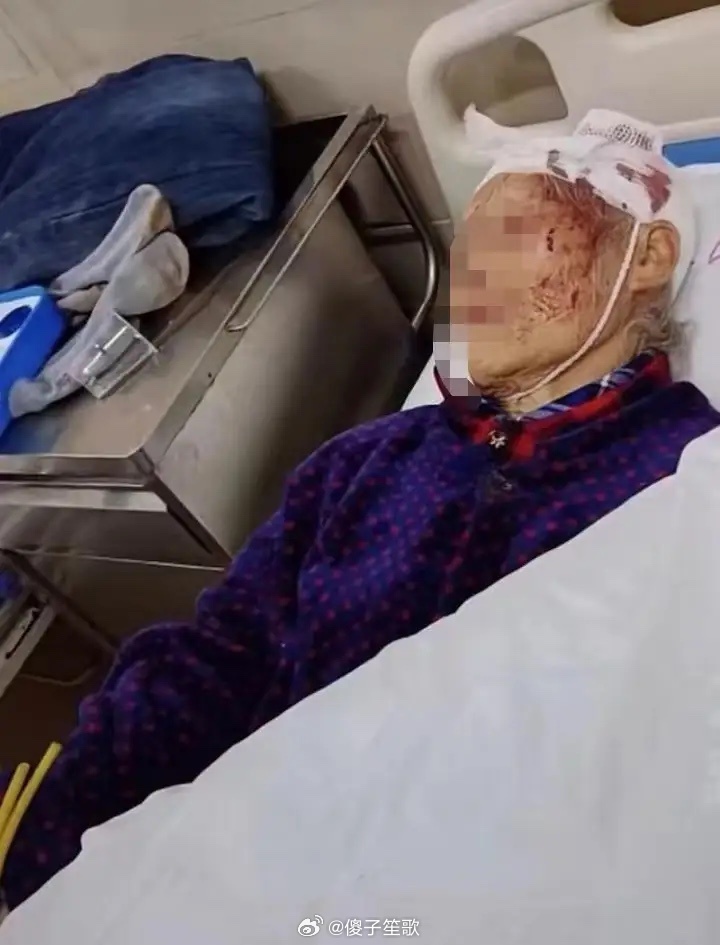 震惊！护女被打成90岁脑龄，真相令人心碎！